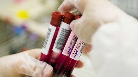 Getty Images Barcodes have not only revolutionised shopping but also keeping track of drugs and samples in healthcare (Credit: Getty Images)